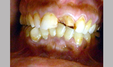 Dental clinic in Anand
                        